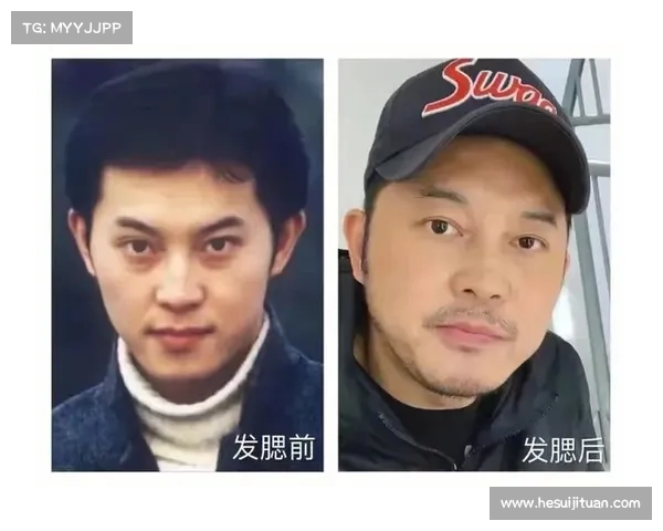 发腮是什么意思